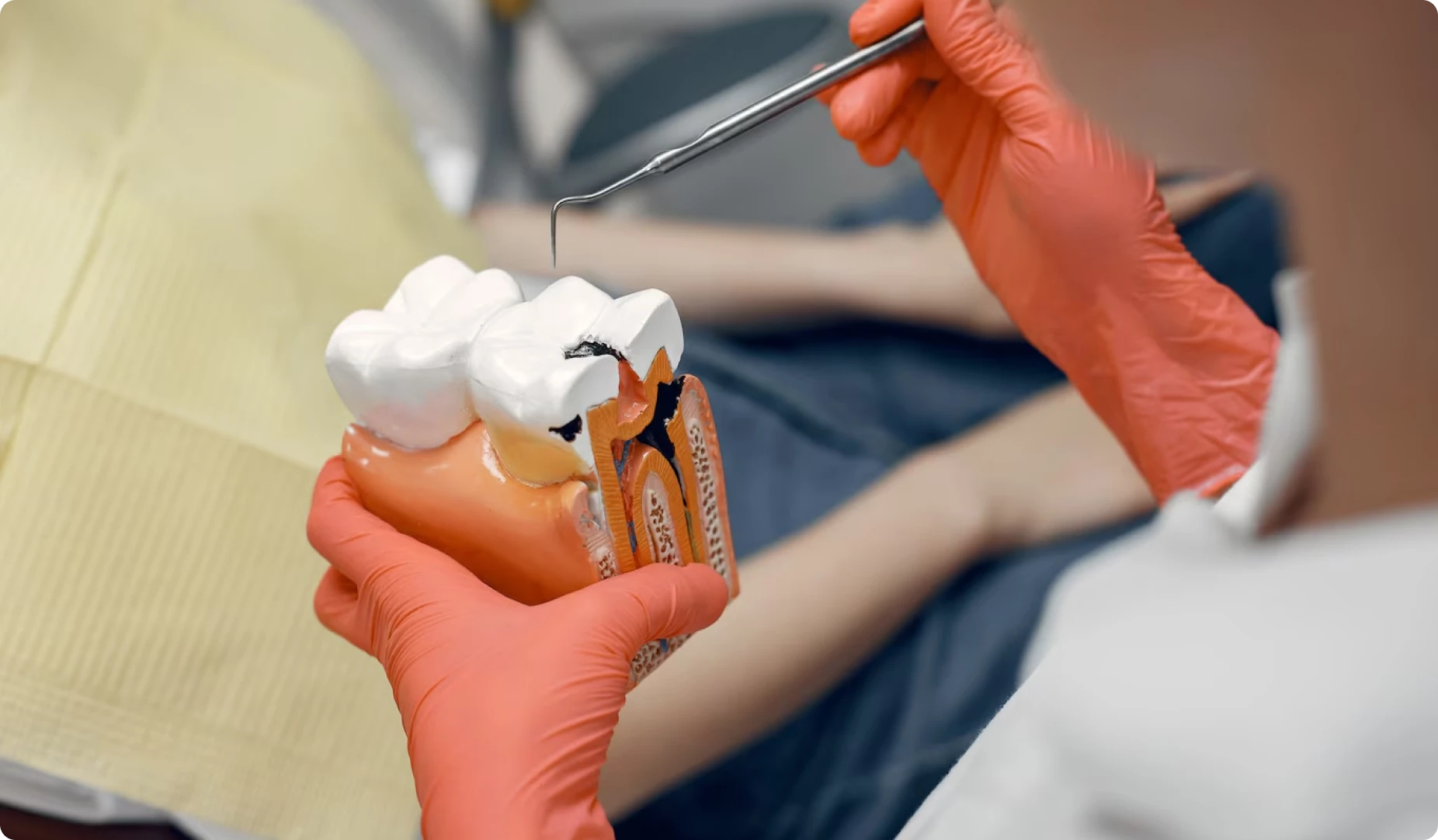 Implantes dentales